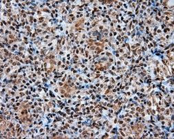 ACLY Antibody in Immunohistochemistry (Paraffin) (IHC (P))