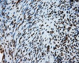 ACLY Antibody in Immunohistochemistry (Paraffin) (IHC (P))