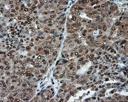 ACLY Antibody in Immunohistochemistry (Paraffin) (IHC (P))