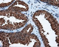 ACLY Antibody in Immunohistochemistry (Paraffin) (IHC (P))