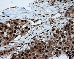 ACLY Antibody in Immunohistochemistry (Paraffin) (IHC (P))