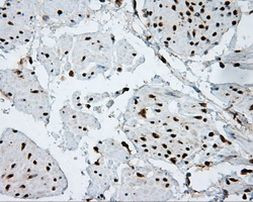 ACLY Antibody in Immunohistochemistry (Paraffin) (IHC (P))