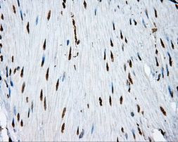 ACLY Antibody in Immunohistochemistry (Paraffin) (IHC (P))