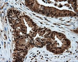 ACLY Antibody in Immunohistochemistry (Paraffin) (IHC (P))