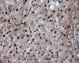 ACLY Antibody in Immunohistochemistry (Paraffin) (IHC (P))