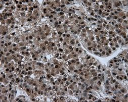 ACLY Antibody in Immunohistochemistry (Paraffin) (IHC (P))