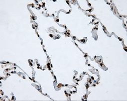 ACLY Antibody in Immunohistochemistry (Paraffin) (IHC (P))