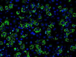 ACO2 Antibody in Immunocytochemistry (ICC/IF)