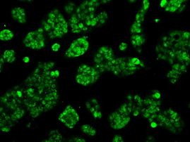 ACO2 Antibody in Immunocytochemistry (ICC/IF)