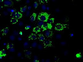 ACO2 Antibody in Immunocytochemistry (ICC/IF)