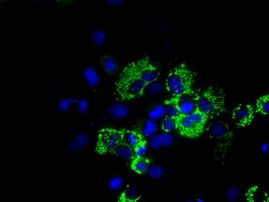 ACO2 Antibody in Immunocytochemistry (ICC/IF)