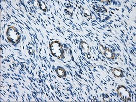 ACO2 Antibody in Immunohistochemistry (Paraffin) (IHC (P))