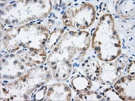 ACO2 Antibody in Immunohistochemistry (Paraffin) (IHC (P))