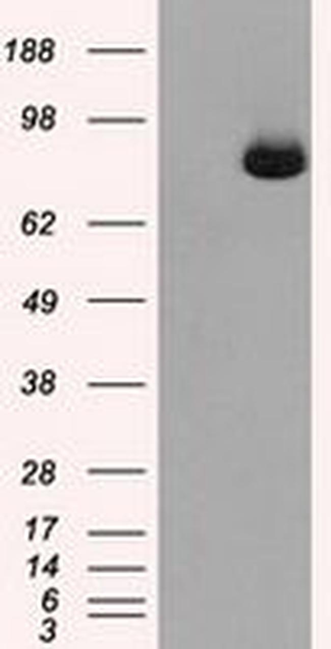 ACO2 Antibody in Western Blot (WB)