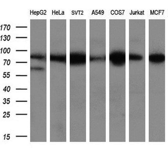 ACO2 Antibody in Western Blot (WB)