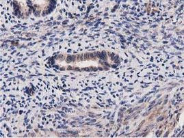 ACOT12 Antibody in Immunohistochemistry (Paraffin) (IHC (P))