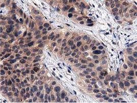 ACOT12 Antibody in Immunohistochemistry (Paraffin) (IHC (P))