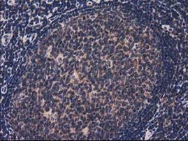 ACOT12 Antibody in Immunohistochemistry (Paraffin) (IHC (P))