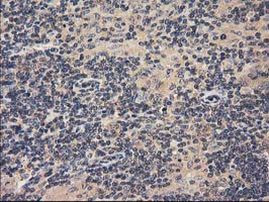 ACOT12 Antibody in Immunohistochemistry (Paraffin) (IHC (P))