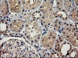 ACOT12 Antibody in Immunohistochemistry (Paraffin) (IHC (P))