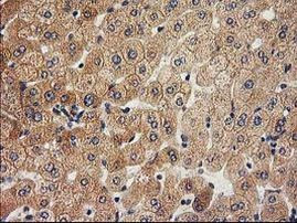 ACOT12 Antibody in Immunohistochemistry (Paraffin) (IHC (P))