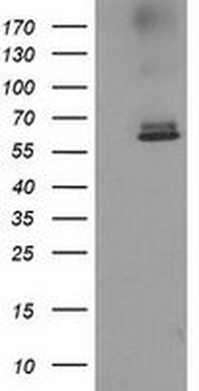 ACOT12 Antibody in Western Blot (WB)