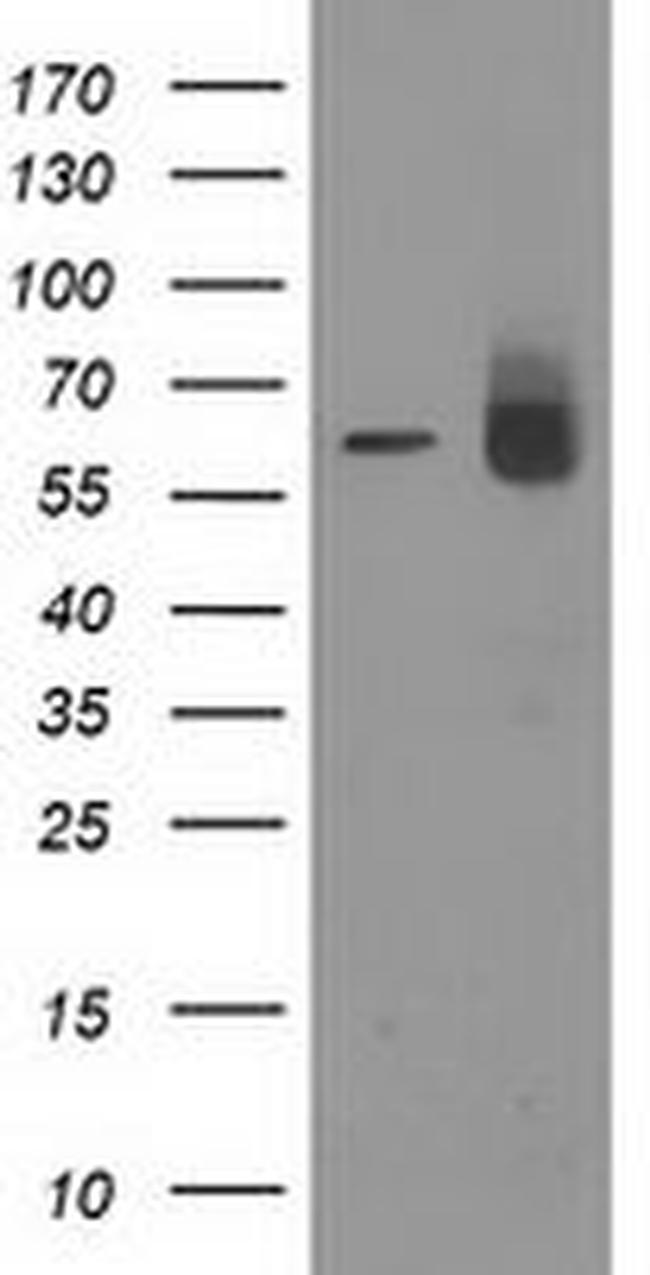 ACOT12 Antibody in Western Blot (WB)