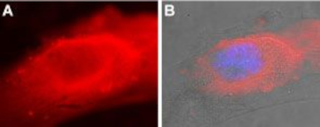 SERCA2 Antibody in Immunocytochemistry (ICC/IF)