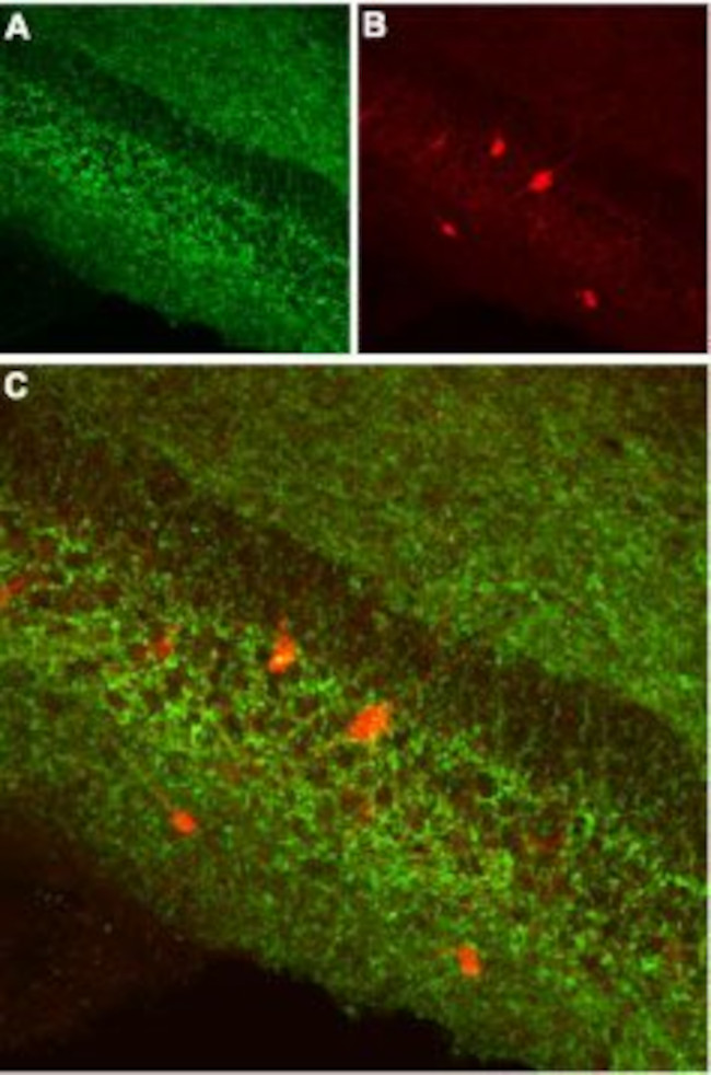 Cannabinoid Receptor 1 (extracellular) Antibody in Immunohistochemistry (IHC)