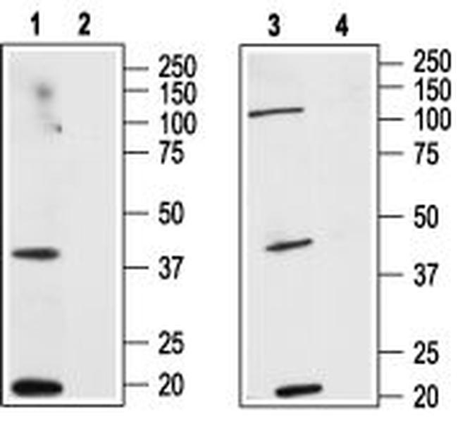 Cannabinoid Receptor 2 (extracellular) Antibody in Western Blot (WB)