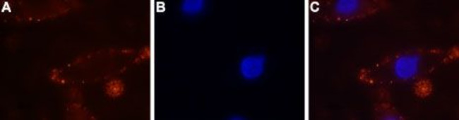 Calcium Sensing Receptor (extracellular) Antibody in Immunocytochemistry (ICC/IF)