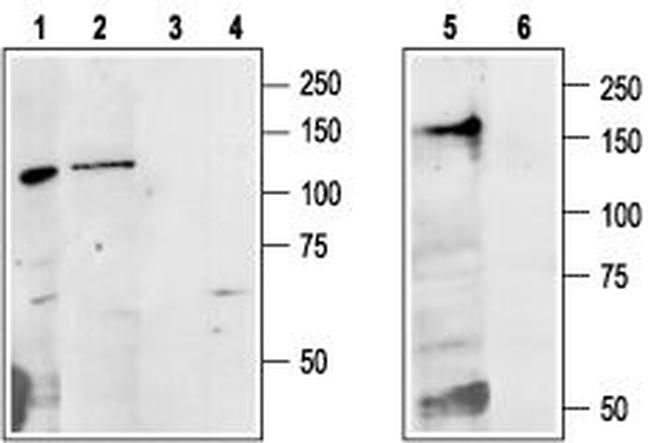Calcium Sensing Receptor (extracellular) Antibody in Western Blot (WB)
