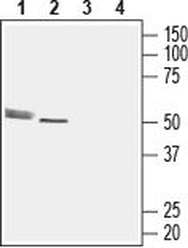 CMKLR1 (extracellular) Antibody in Western Blot (WB)