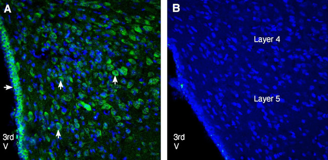 CCKBR (extracellular) Antibody in Immunohistochemistry (Frozen) (IHC (F))