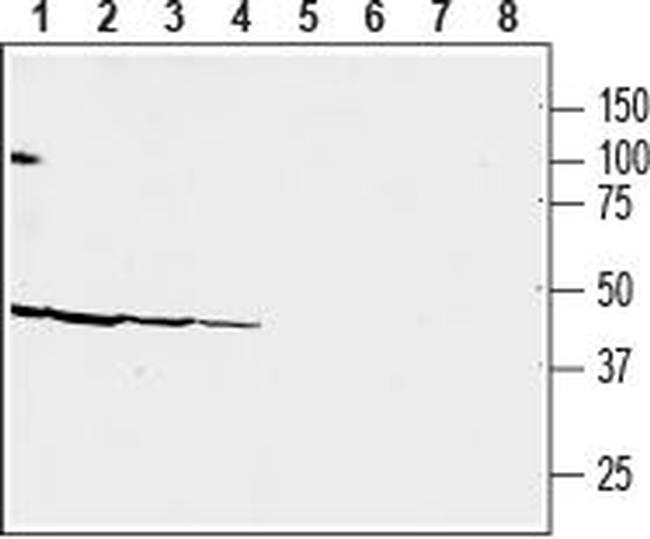 CRF2/CRHR2 (extracellular) Antibody in Western Blot (WB)