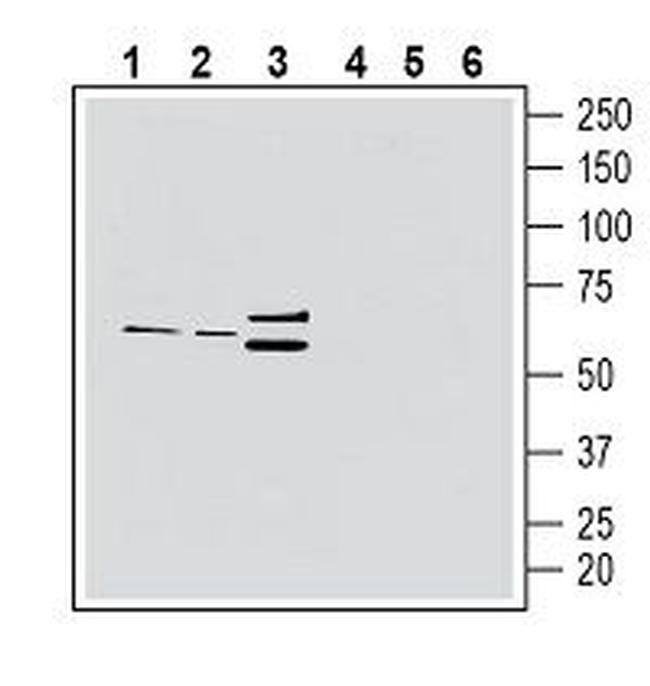 CX3CR1 (extracellular) Antibody in Western Blot (WB)