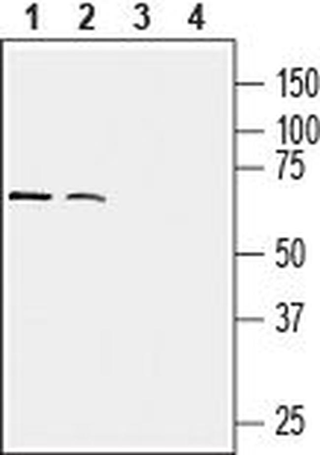 CX3CR1 (extracellular) Antibody in Western Blot (WB)