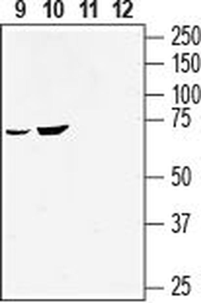 GPR55 (extracellular) Antibody in Western Blot (WB)