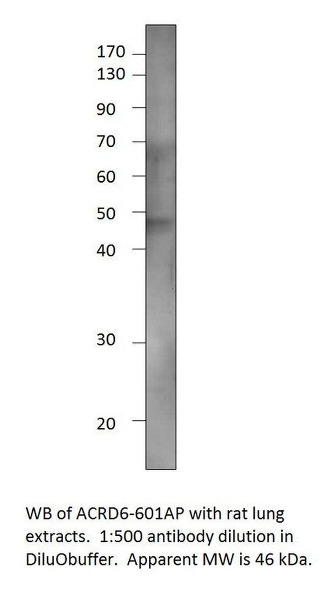 Atypical Chemokine Receptor D6 Antibody in Western Blot (WB)