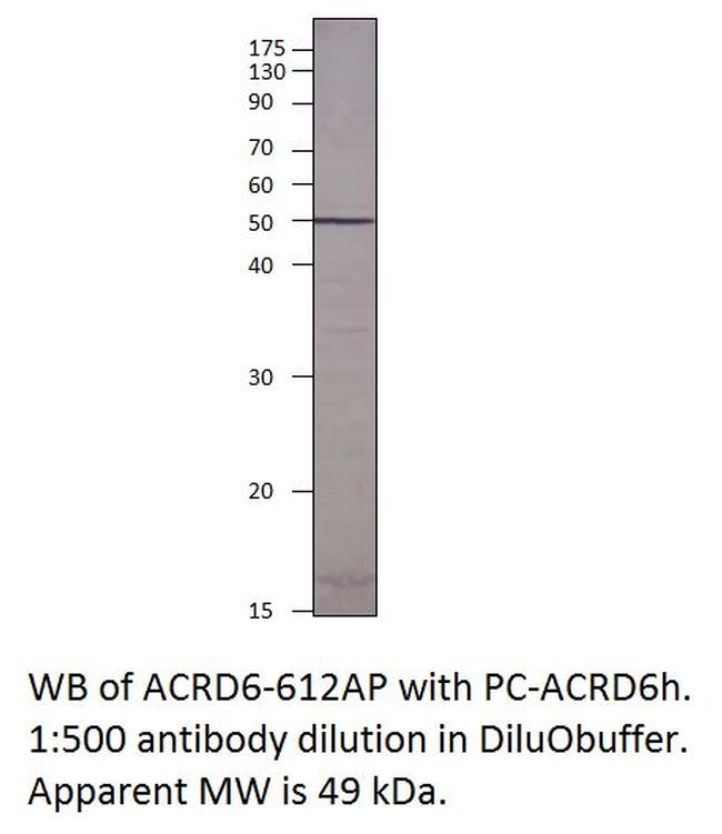 Atypical Chemokine Receptor D6 Antibody in Western Blot (WB)