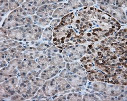 ACSBG1 Antibody in Immunohistochemistry (Paraffin) (IHC (P))