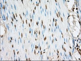 ACSBG1 Antibody in Immunohistochemistry (Paraffin) (IHC (P))