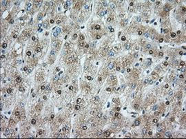 ACSBG1 Antibody in Immunohistochemistry (Paraffin) (IHC (P))