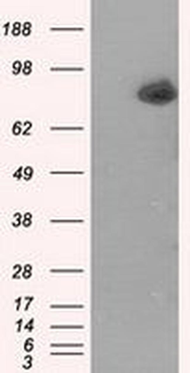 ACSBG1 Antibody in Western Blot (WB)