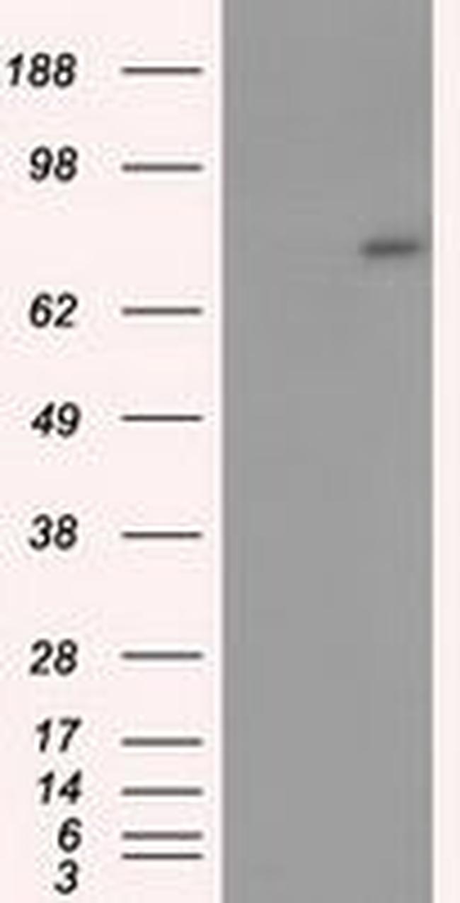 ACSBG1 Antibody in Western Blot (WB)