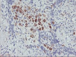 ACSF2 Antibody in Immunohistochemistry (Paraffin) (IHC (P))