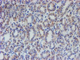 ACSF2 Antibody in Immunohistochemistry (Paraffin) (IHC (P))