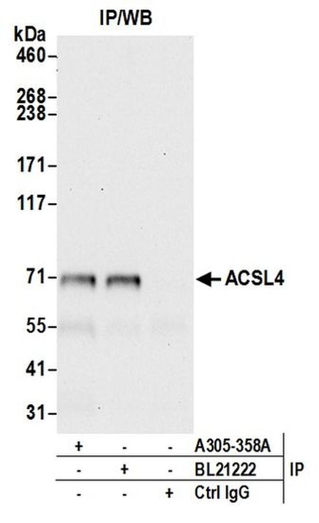 ACSL4/FACL4 Antibody in Western Blot (WB)