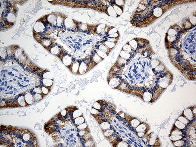 ACSL5 Antibody in Immunohistochemistry (Paraffin) (IHC (P))