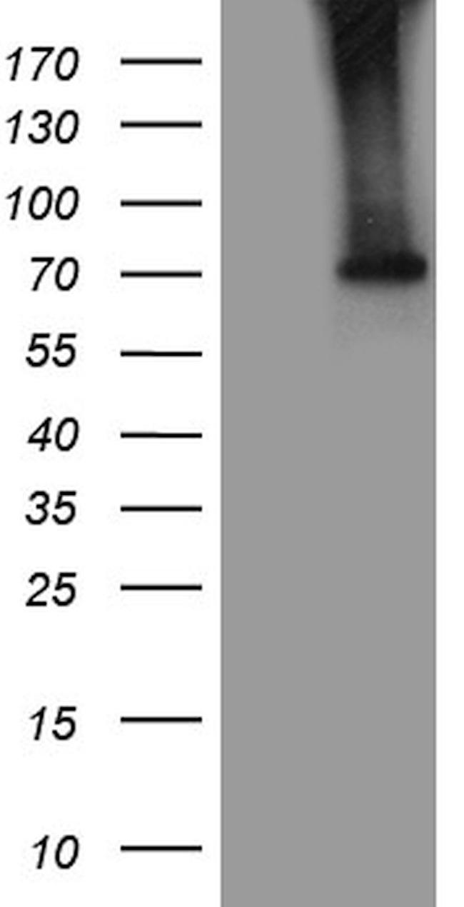 ACSL5 Antibody in Western Blot (WB)